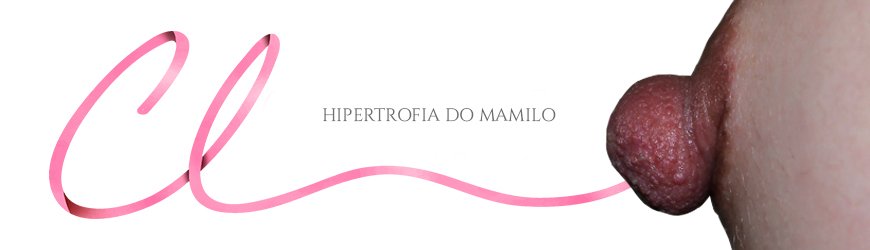 Cirurgia de Hipertrofia de Mamilo