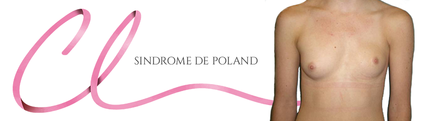 Cirurgia de Síndrome de Poland