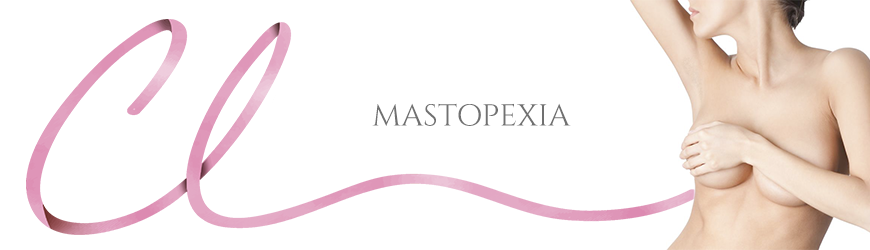 Mastopexia